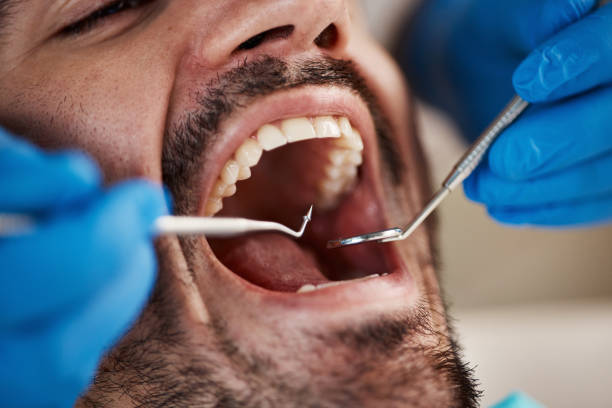 Best Affordable Emergency Dental Care  in Bear Valley Springs, CA