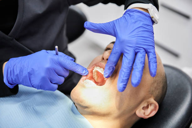Best Chipped Tooth Repair Near Me  in Bear Valley Springs, CA